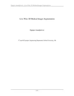 Live-wire 3D medical images segmentation