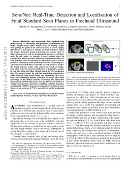 SonoNet: Real-Time Detection and Localisation of Fetal Standard Scan
  Planes in Freehand Ultrasound