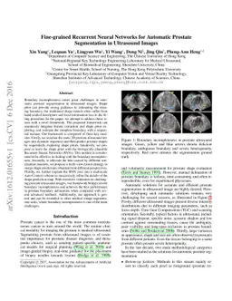 Fine-grained Recurrent Neural Networks for Automatic Prostate
  Segmentation in Ultrasound Images