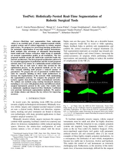 ToolNet: Holistically-Nested Real-Time Segmentation of Robotic Surgical
  Tools