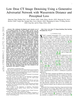 Low Dose CT Image Denoising Using a Generative Adversarial Network with
  Wasserstein Distance and Perceptual Loss