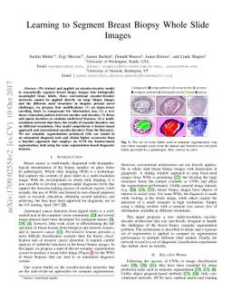 Learning to Segment Breast Biopsy Whole Slide Images