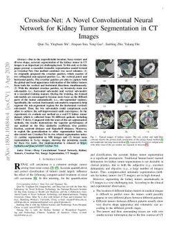 Crossbar-Net: A Novel Convolutional Network for Kidney Tumor
  Segmentation in CT Images