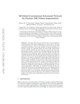 3D Global Convolutional Adversarial Network\\ for Prostate MR Volume
  Segmentation