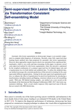 Semi-supervised Skin Lesion Segmentation via Transformation Consistent
  Self-ensembling Model