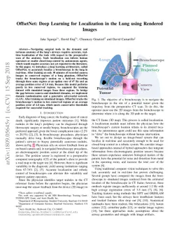 OffsetNet: Deep Learning for Localization in the Lung using Rendered
  Images