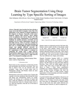 Brain Tumor Segmentation Using Deep Learning by Type Specific Sorting of
  Images