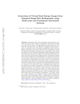 Generation of Virtual Dual Energy Images from Standard Single-Shot
  Radiographs using Multi-scale and Conditional Adversarial Network