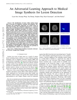 An Adversarial Learning Approach to Medical Image Synthesis for Lesion
  Detection