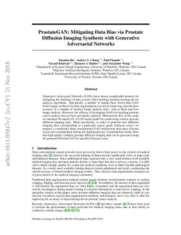 ProstateGAN: Mitigating Data Bias via Prostate Diffusion Imaging
  Synthesis with Generative Adversarial Networks