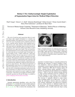 Retina U-Net: Embarrassingly Simple Exploitation of Segmentation
  Supervision for Medical Object Detection