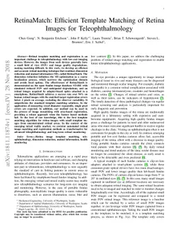 RetinaMatch: Efficient Template Matching of Retina Images for
  Teleophthalmology