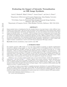 Evaluating the Impact of Intensity Normalization on MR Image Synthesis