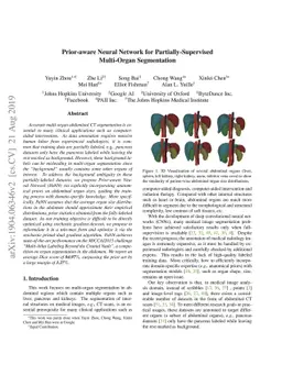 Prior-aware Neural Network for Partially-Supervised Multi-Organ
  Segmentation