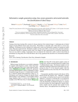 Informative sample generation using class aware generative adversarial
  networks for classification of chest Xrays
