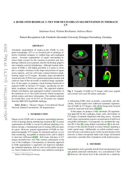 A 2D dilated residual U-Net for multi-organ segmentation in thoracic CT