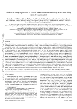 Multi-atlas image registration of clinical data with automated quality
  assessment using ventricle segmentation