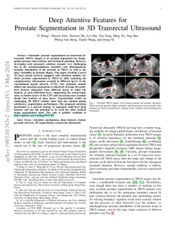 Deep Attentive Features for Prostate Segmentation in 3D Transrectal
  Ultrasound