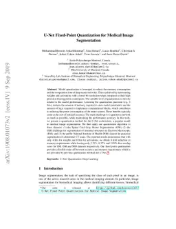 U-Net Fixed-Point Quantization for Medical Image Segmentation