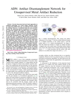 ADN: Artifact Disentanglement Network for Unsupervised Metal Artifact
  Reduction