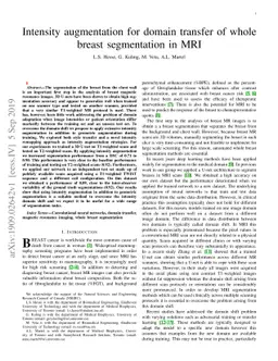 Intensity augmentation for domain transfer of whole breast segmentation
  in MRI