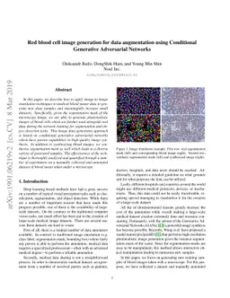 Red blood cell image generation for data augmentation using Conditional
  Generative Adversarial Networks