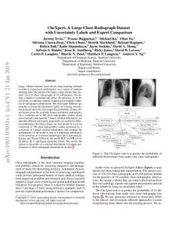 CheXpert: A Large Chest Radiograph Dataset with Uncertainty Labels and
  Expert Comparison