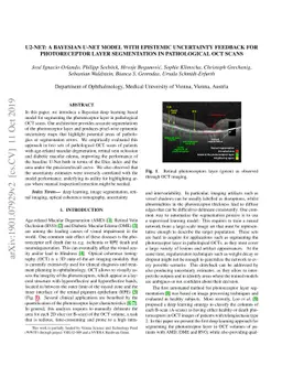 U2-Net: A Bayesian U-Net model with epistemic uncertainty feedback for
  photoreceptor layer segmentation in pathological OCT scans