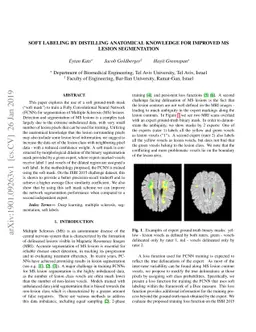 Soft labeling by Distilling Anatomical knowledge for Improved MS Lesion
  Segmentation
