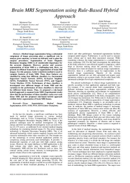 Brain MRI Segmentation using Rule-Based Hybrid Approach