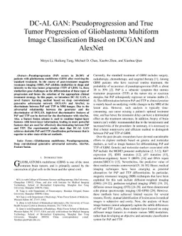 DC-AL GAN: Pseudoprogression and True Tumor Progression of Glioblastoma
  Multiform Image Classification Based on DCGAN and AlexNet