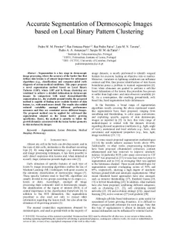 Accurate Segmentation of Dermoscopic Images based on Local Binary
  Pattern Clustering