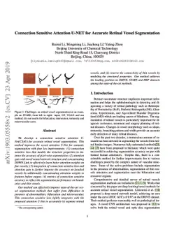 Connection Sensitive Attention U-NET for Accurate Retinal Vessel
  Segmentation