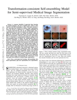 Transformation Consistent Self-ensembling Model for Semi-supervised
  Medical Image Segmentation