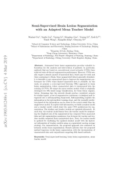 Semi-Supervised Brain Lesion Segmentation with an Adapted Mean Teacher
  Model