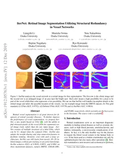 IterNet: Retinal Image Segmentation Utilizing Structural Redundancy in
  Vessel Networks
