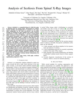 Analysis of Scoliosis From Spinal X-Ray Images