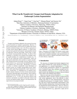 What Can Be Transferred: Unsupervised Domain Adaptation for Endoscopic
  Lesions Segmentation