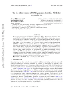 On the effectiveness of GAN generated cardiac MRIs for segmentation