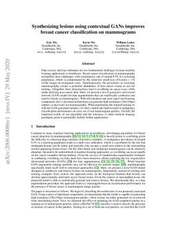 Synthesizing lesions using contextual GANs improves breast cancer
  classification on mammograms