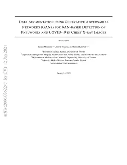 Data Augmentation using Generative Adversarial Networks (GANs) for
  GAN-based Detection of Pneumonia and COVID-19 in Chest X-ray Images
