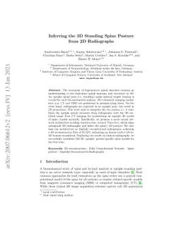 Inferring the 3D Standing Spine Posture from 2D Radiographs