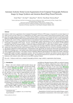 Automatic Ischemic Stroke Lesion Segmentation from Computed Tomography
  Perfusion Images by Image Synthesis and Attention-Based Deep Neural Networks