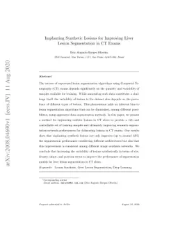 Implanting Synthetic Lesions for Improving Liver Lesion Segmentation in
  CT Exams