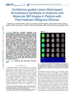 Confidence-guided Lesion Mask-based Simultaneous Synthesis of Anatomic
  and Molecular MR Images in Patients with Post-treatment Malignant Gliomas