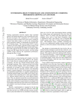 Synthesizing brain tumor images and annotations by combining progressive
  growing GAN and SPADE