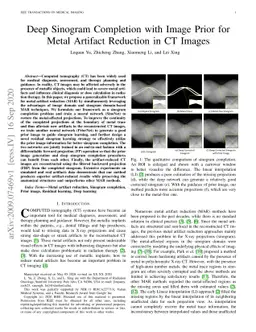 Deep Sinogram Completion with Image Prior for Metal Artifact Reduction
  in CT Images