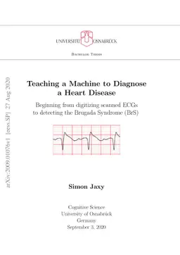 Teaching a Machine to Diagnose a Heart Disease; Beginning from
  digitizing scanned ECGs to detecting the Brugada Syndrome (BrS)