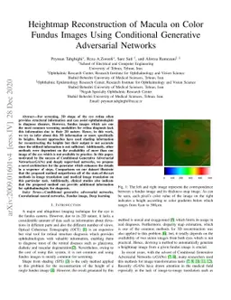 Heightmap Reconstruction of Macula on Color Fundus Images Using
  Conditional Generative Adversarial Networks