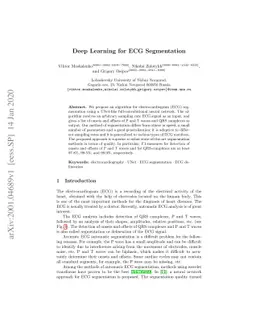 Deep Learning for ECG Segmentation